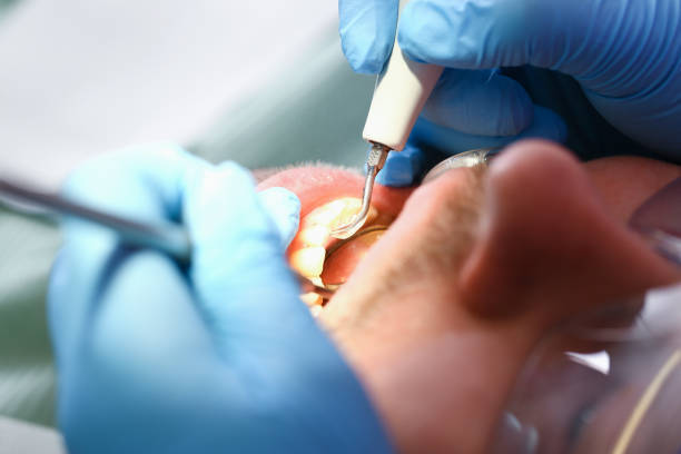 Dentist for Dental Trauma in MA