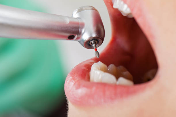 Best Knocked-Out Tooth Emergency  in Framingham, MA